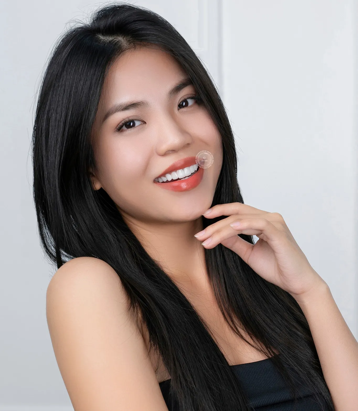 Hãy nhớ chăm sóc răng dán sứ Veneer để nụ cười sáng đẹp lâu bền